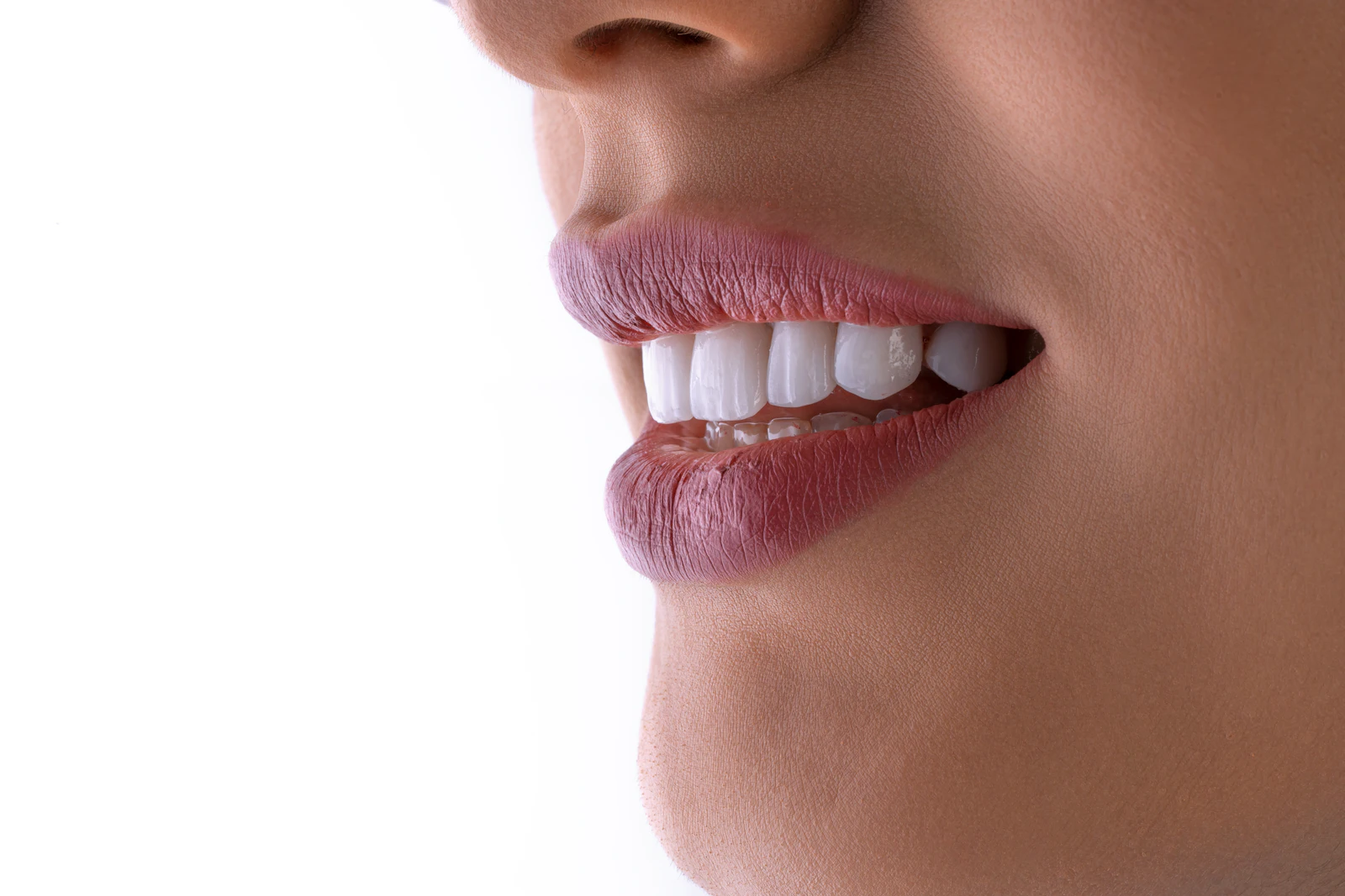 Estética dental en Clínica Dental Arenal
